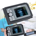 668815620180919001 Carejoy Handheld Ultrasound Scanner Medical Rectal Probe For 190891292612