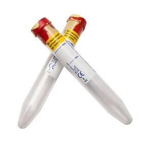 364992 Becton Dickinson Urine Collection Analysis Tubes 100 1 Rack . Bd