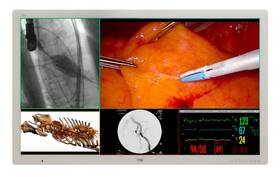 Fm-d5801dv Fsn 58 Inch 4k Lcd Color Surgical Medical Display Monitor Fm-d5801dv Fsn 58 Inch 4k Lcd Color Surgical Medical Display Monitor