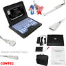 Cms600p2 Portable B-ultrasound Scanner Laptop Machine Ultrasonic Systems 4 Probe Optional