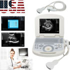 Rus-9000a2 Carejoy Inch Laptop Full Digital Medical Ultrasound Scanner Cavity Probe