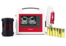 100550 Vitacon Pd Bladder Scan System 100550 Vitacon Pd Bladder Scan System