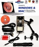 Rigid Endoscope Endoscopy For Arthrex Hd Usb Camera+coupler+light Source+mount. Fixed Price $425.00.