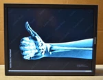 Grade B Totoku/jvc CCL356I2 21.3" Monitor Radiology 2048X1536 Dvi Dport No Stand. Fixed Price $59.99.