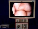 Richard Wolf 5550HD/5131/26 Monitor Vs STRYKER1288/1488/STORZ IMAGE1/IM4000. Fixed Price $4250.00.
