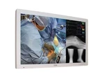Fsn FM-D5801DV 58-INCH 4K Uhd Surgical Lcd Monitor. Fixed Price $2497.50.